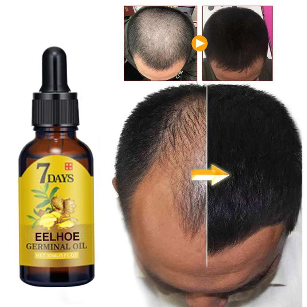 Ginger Moisturizing  Hair Anti-drop Solution