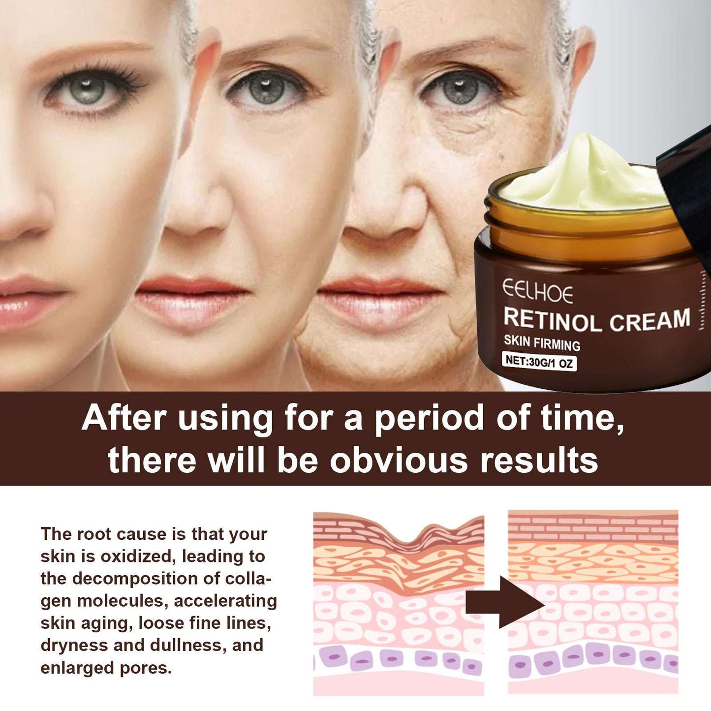 EELHOE Anti-Aging Retinol Cream