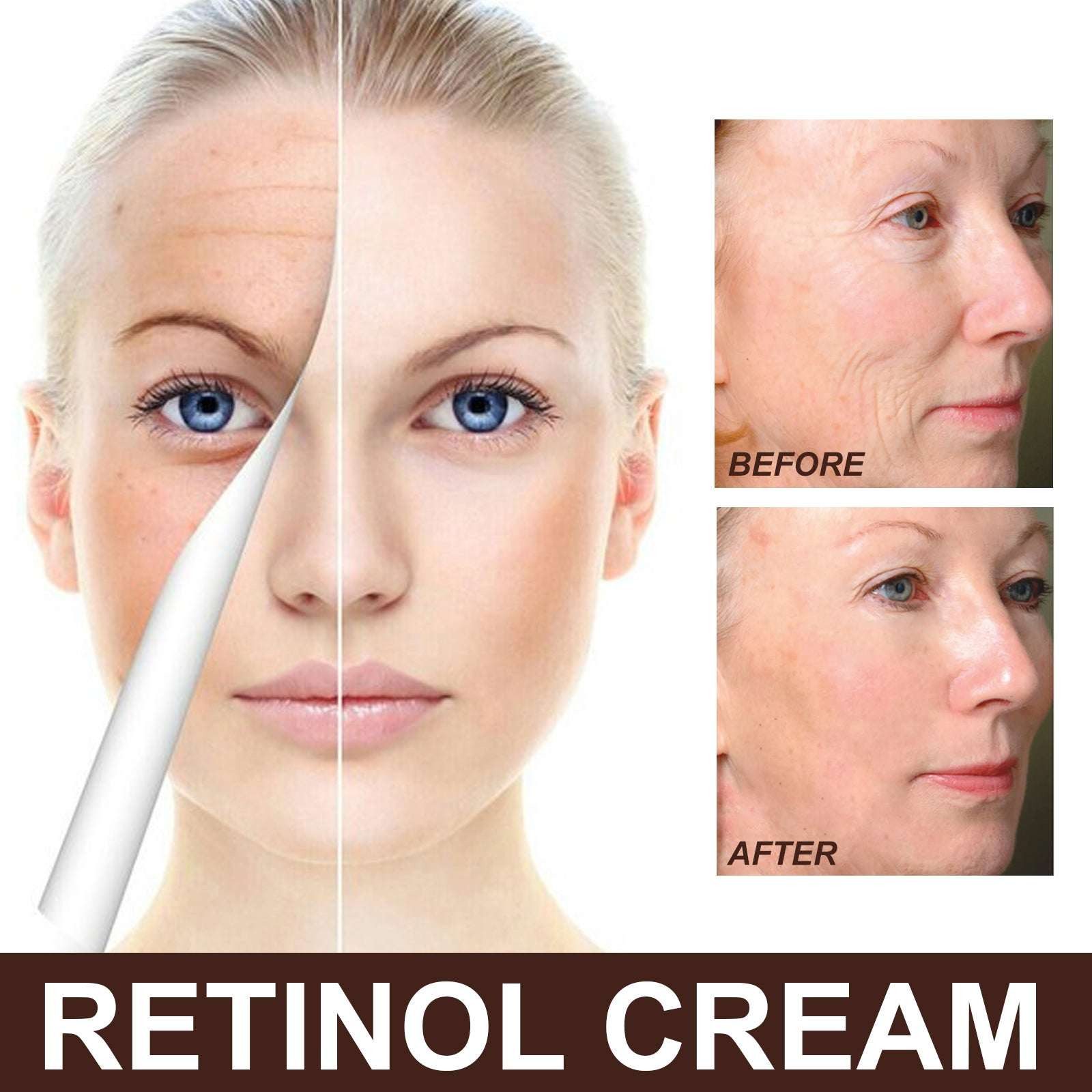 EELHOE Anti-Aging Retinol Cream